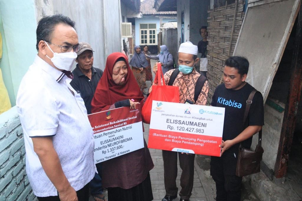 podiumnews.com-Derita Tumor Wajah, Elis Tak Surut Kejar Cita-cita